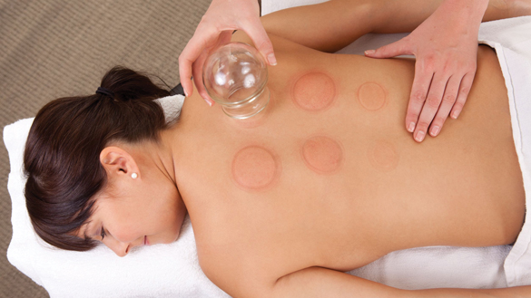 Cupping_shutterstock