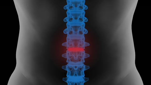 Lumbar vertebrae
